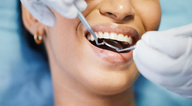 Best Emergency Root Canal Treatment in Copper Canyon, TX
