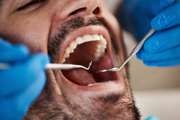 Best Emergency Treatment for Dental Infections or Abscesses in Copper Canyon, TX
